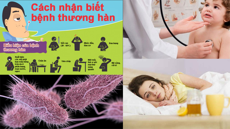 Biểu hiện bệnh thương hàn